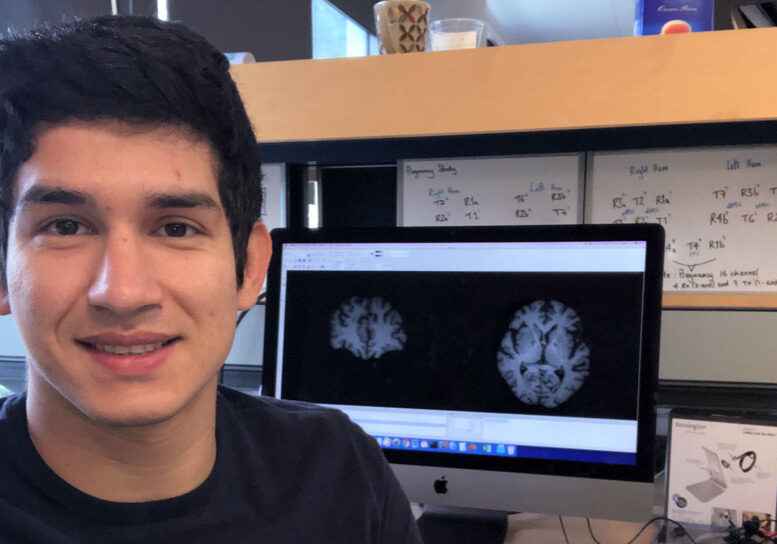 Dr. Nárlon Cássio Boa Sorte Silva